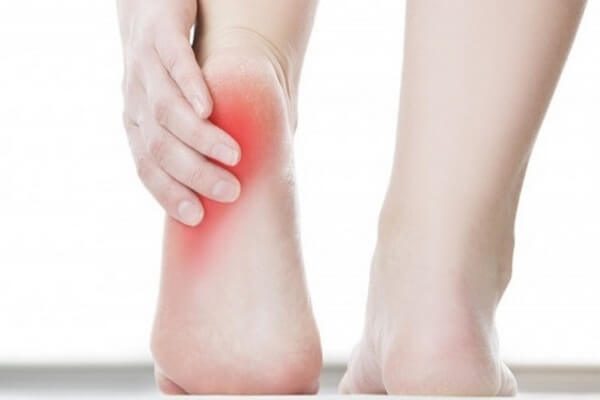 HY House - Cẩn trọng với bệnh đau gót chân